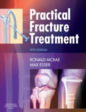 book Practical fracture treatment