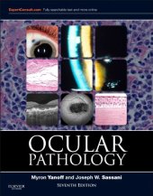 book Ocular pathology