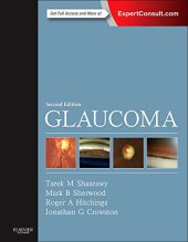 book Glaucoma : includes medical diagnosis and therapy and surgical