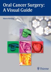 book Oral Cancer Surgery: A Visual Guide