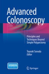 book Advanced Colonoscopy: Principles and Techniques Beyond Simple Polypectomy