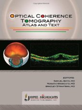 book Optical Coherence Tomography—Atlas and Text