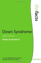 book Down Syndrome