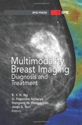 book Multimodality Breast Imaging: Diagnosis and Treatment