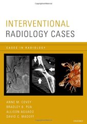 book Interventional Radiology Cases