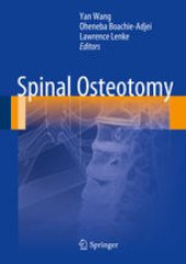 book Spinal Osteotomy