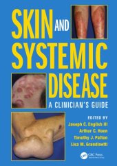 book Skin and Systemic Disease : a Clinician's Guide