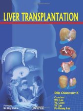 book Liver Transplantation