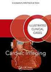 book Cardiac Imaging