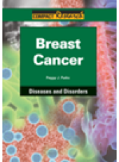 book Breast Cancer