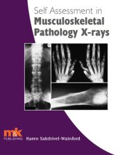 book Self-assessment in axial skeleton musculoskeletal trauma X-rays