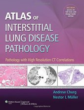 book Atlas of Interstitial Lung Disease Pathology: Pathology with High Resolution CT Correlations