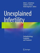 book Unexplained Infertility: Pathophysiology, Evaluation and Treatment