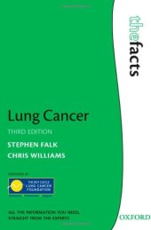 book Lung Cancer