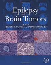 book Epilepsy and Brain Tumors