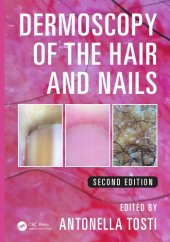 book Dermoscopy of the hair and nails