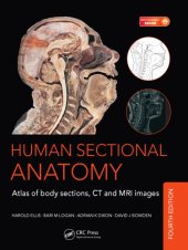 book Human sectional anatomy : atlas of body sections, CT and MRI images