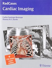 book Cardiac Imaging