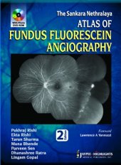 book The Sankara Nethralaya Atlas of Fundus Fluorescein Angiography