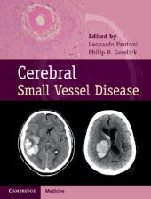 book Cerebral Small Vessel Disease