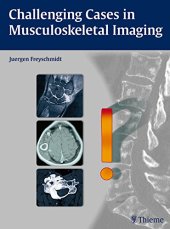 book Challenging Cases in Musculoskeletal Imaging