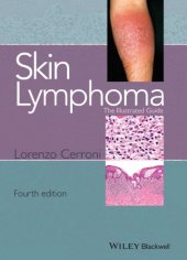 book Skin Lymphoma: The Illustrated Guide