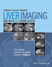 book Liver Imaging: MRI with CT Correlation