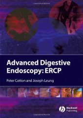 book Advanced digestive endoscopy : ERCP