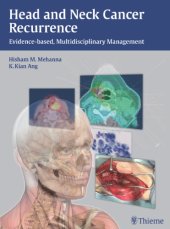 book Head and Neck Cancer Recurrence: Evidence-based, Multidisciplinary Management