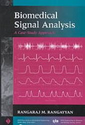 book Biomedical signal analysis : a case-study approach