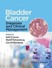 book Bladder cancer : diagnosis and clinical management