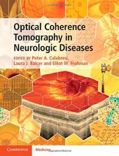 book Optical Coherence Tomography in Neurologic Diseases