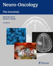 book Neuro-Oncology: The Essentials