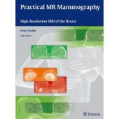 book Practical MR Mammography: High-Resolution MRI of the Breast