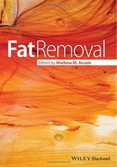 book Fat removal : invasive and non-invasive body contouring