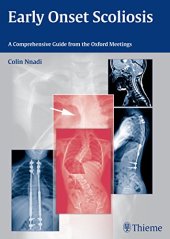 book Early Onset Scoliosis: A Comprehensive Guide from the Oxford Meetings