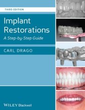 book Implant restorations : a step by step guide