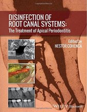 book Disinfection of root canal systems : the treatment of apical periodontitis