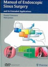 book Manual of endoscopic sinus surgery and its extended applications