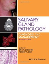 book Salivary gland pathology : diagnosis and management