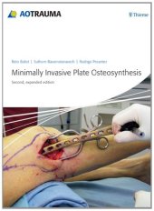 book Minimally Invasive Plate Osteosynthesis