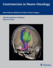 book Controversies in neuro-oncology : best-evidence medicine for brain tumor surgery