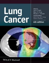 book Lung Cancer