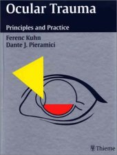 book Ocular trauma : principles and practice