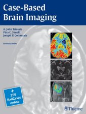 book Case-Based Brain Imaging