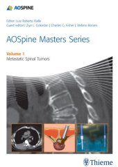 book AOSpine Masters Series Volume 1: Metastatic Spinal Tumors