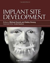 book Implant Site Development