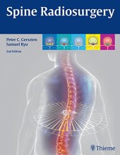 book Spine Radiosurgery