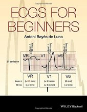 book ECGs for Beginners