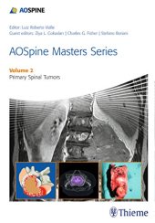 book AOSpine masters series. Volume 2, Primary spinal tumors